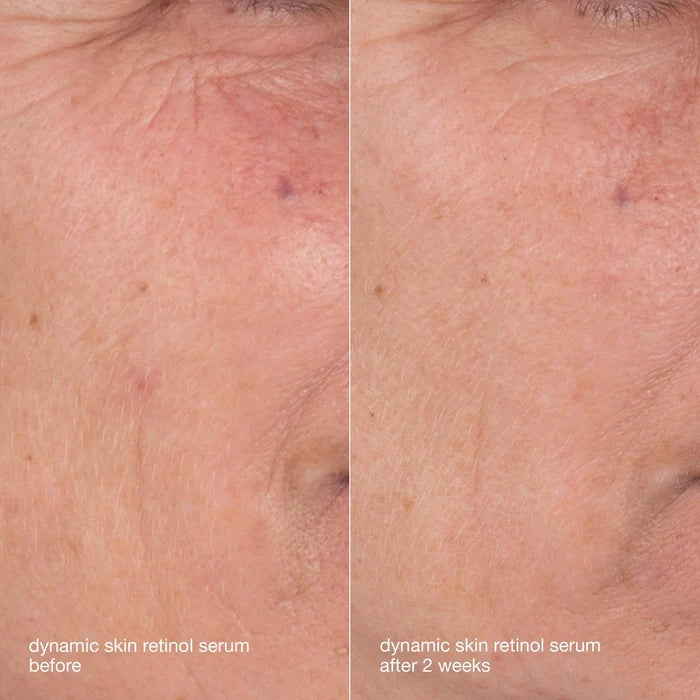 Skin Ageing Solutions Kit